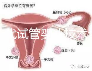 第一代試管嬰兒技術(shù)全解析:流程、適應(yīng)癥及優(yōu)缺點(diǎn)指南