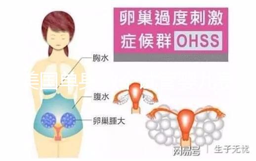 美國單身做個(gè)試管嬰兒費(fèi)用大概要多少?