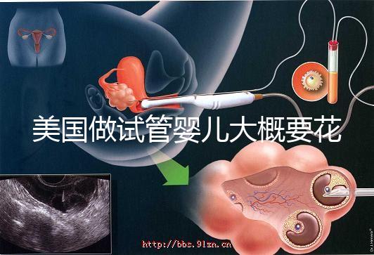 美國做試管嬰兒大概要花多少錢？具體支出25w！