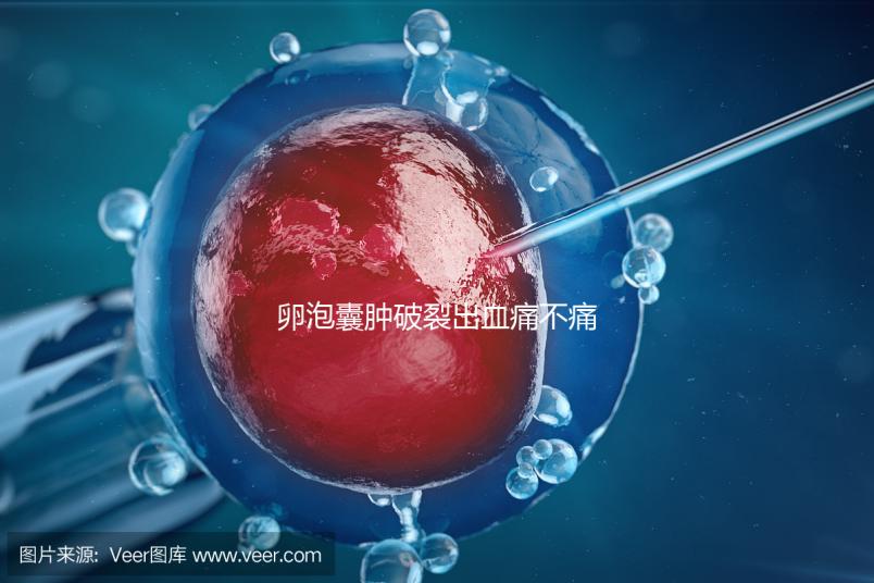 卵泡囊腫破裂出血痛不痛？經歷過的姐妹們給出回應