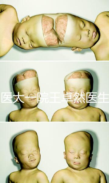 哈醫大一院王卓然醫生試管攻略,坐診時間、成功率早知道