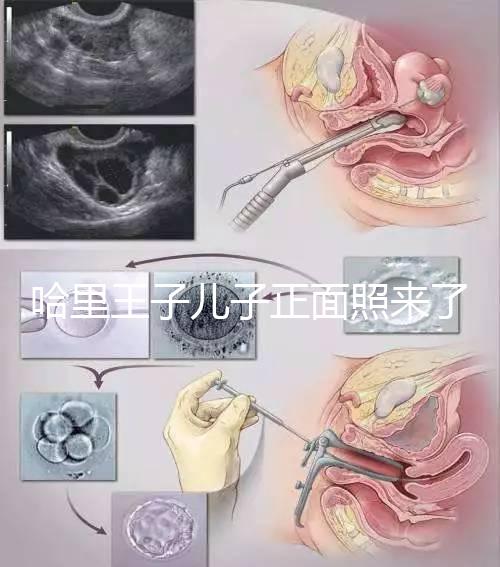 哈里王子兒子正面照來了，梅根評價：氣質甜美，乖巧