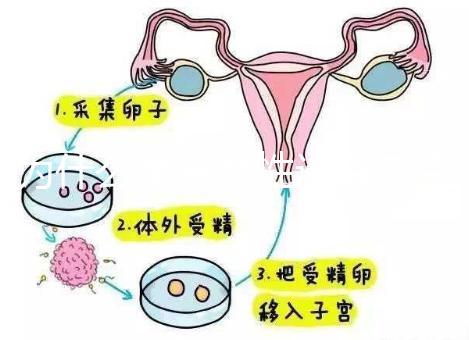 為什么單身女性選擇烏克蘭MINI醫(yī)院試管嬰兒？詳細分析三個原因