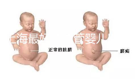 上海最好的試管嬰兒醫(yī)院信息匯總,想要最權威真得看這幾家