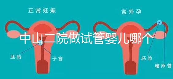 中山二院做試管嬰兒哪個醫(yī)生好?附醫(yī)院試管成功率