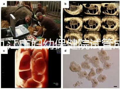 九江市婦幼保健院試管成功率高、費(fèi)用低？生殖醫(yī)生揭開真相