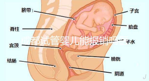 成都試管嬰兒能報銷嗎醫保?政策解讀