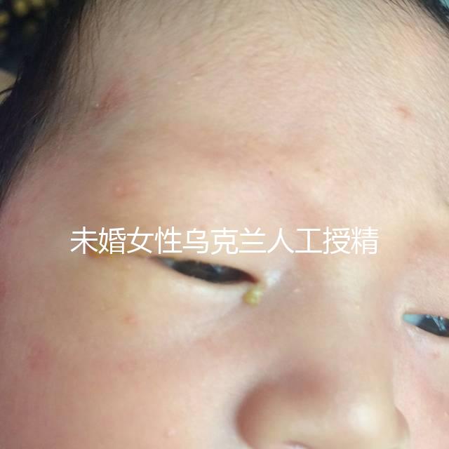 未婚女性烏克蘭人工授精必看!醫(yī)療及生活費用明細預(yù)覽