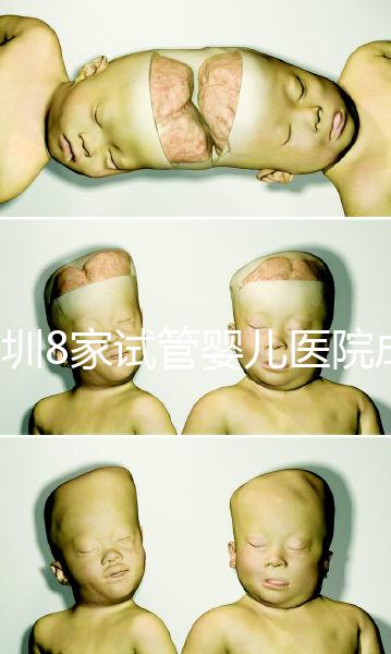 深圳8家試管嬰兒醫(yī)院成功率排名，供卵、供精首選各不同