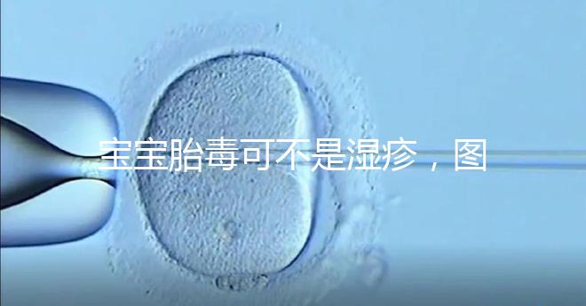 寶寶胎毒可不是濕疹,圖文解讀兩者詳細區(qū)別