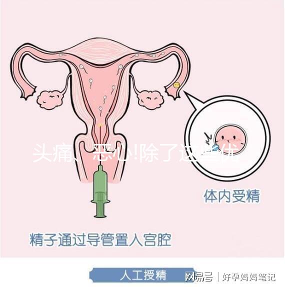 頭痛、惡心!除了這些優思明副作用還有哪些