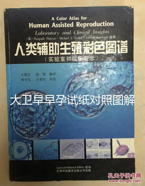 大衛(wèi)早早孕試紙對(duì)照?qǐng)D解,教你怎么看結(jié)果是不是陽性