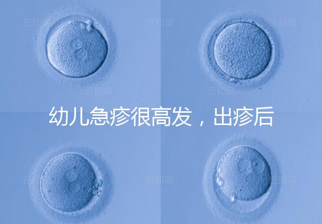 幼兒急疹很高發,出疹后的護理方法及注意事項提前知曉!