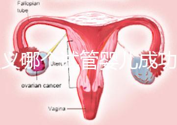 遵義哪個試管嬰兒成功率高?貴州生殖中心醫院2024年排名參考