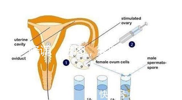 降調，進周，囊胚……這些試管嬰兒助孕術語你都懂嗎？