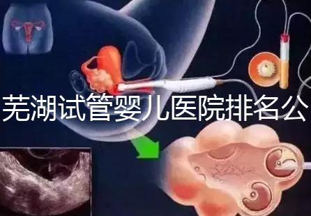 蕪湖試管嬰兒醫院排名公開，弋磯山醫院、蕪湖二院獲好評