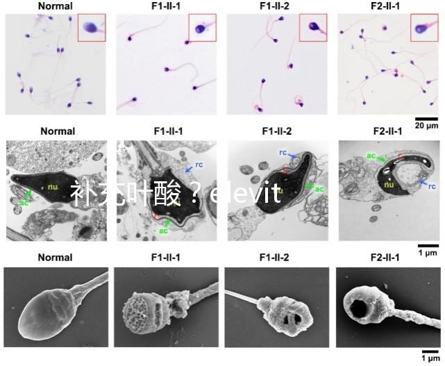 補充葉酸？elevit愛樂維那你不得不了解