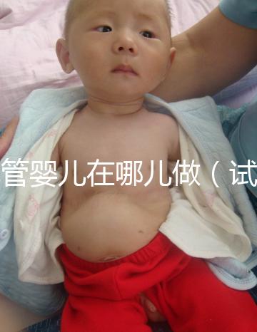 試管嬰兒在哪兒做(試管嬰兒在哪兒做最好啊)