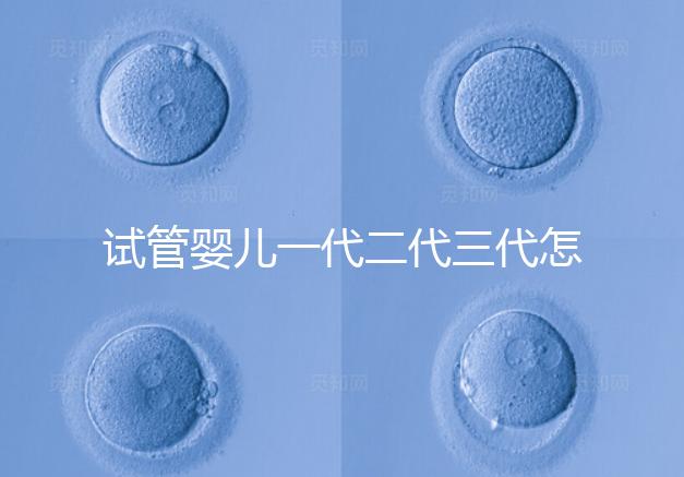 試管嬰兒一代二代三代怎么選？