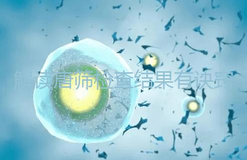 解讀唐篩檢查結果有訣竅，會看報告單上的正常值范圍是關鍵