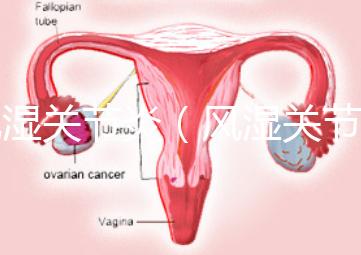 風濕關節炎（風濕關節炎的癥狀有哪些）
