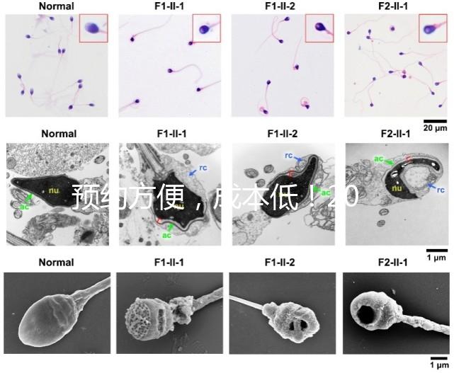 預約方便，成本低！2024年西安新城、臨潼、雁塔四維彩超指南