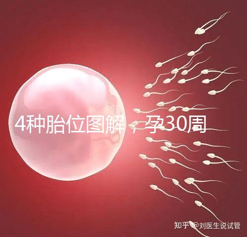 4種胎位圖解，孕30周這個姿勢最適合順產