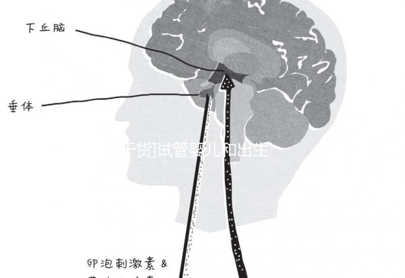 [干貨](méi)試管嬰兒和出生缺陷